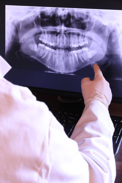 Best Emergency Dental Services for Seniors in Cypress Lake, FL